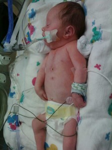 Julie recovering from the second surgery