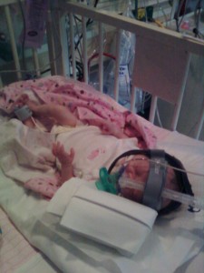 Julie shortly before 3rd surgery