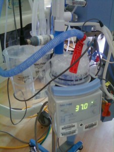 Julie replaced her BFF for this CPAP machine