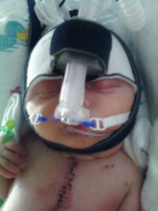 Along with the CPAP machine comes this fashionable head gear