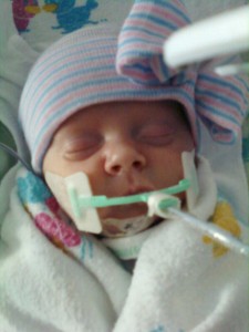 Swaddled before 2nd surgery