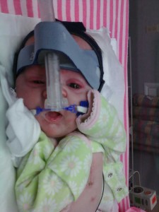Wrong CPAP Mask Position