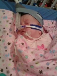 Correct CPAP Mask Position