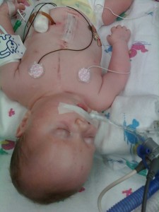Looking good after 4th surgery